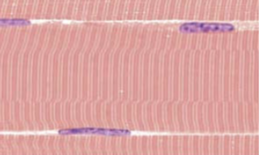 <p>myofilaments arranged in alternating light and dark regions, appears striped (striated) under microscope</p>
