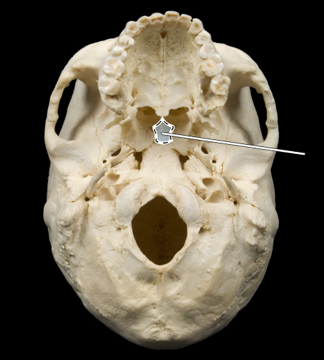 <p>Name this bone.</p><p>(Skull, inferior view).</p>