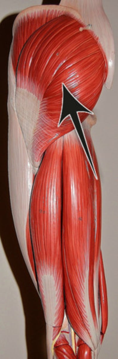 <p>Extends and laterally rotates thigh, braces knee</p>