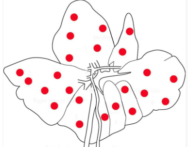 <p>Describe this distribution</p>