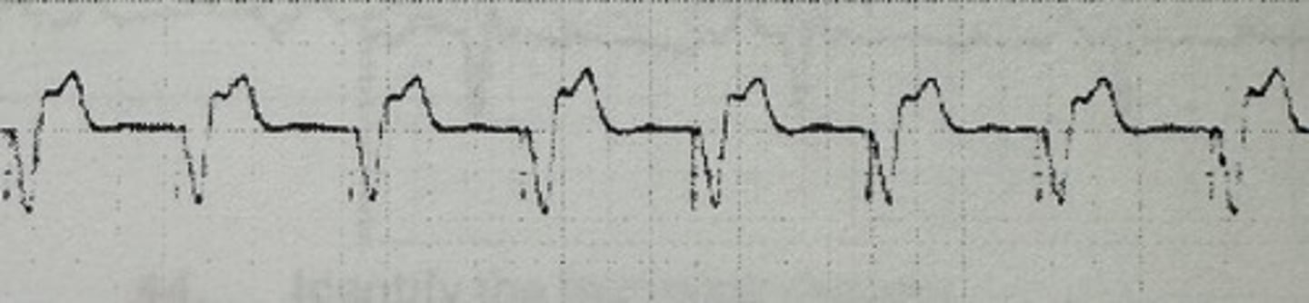 <p>identify the rhythm</p>