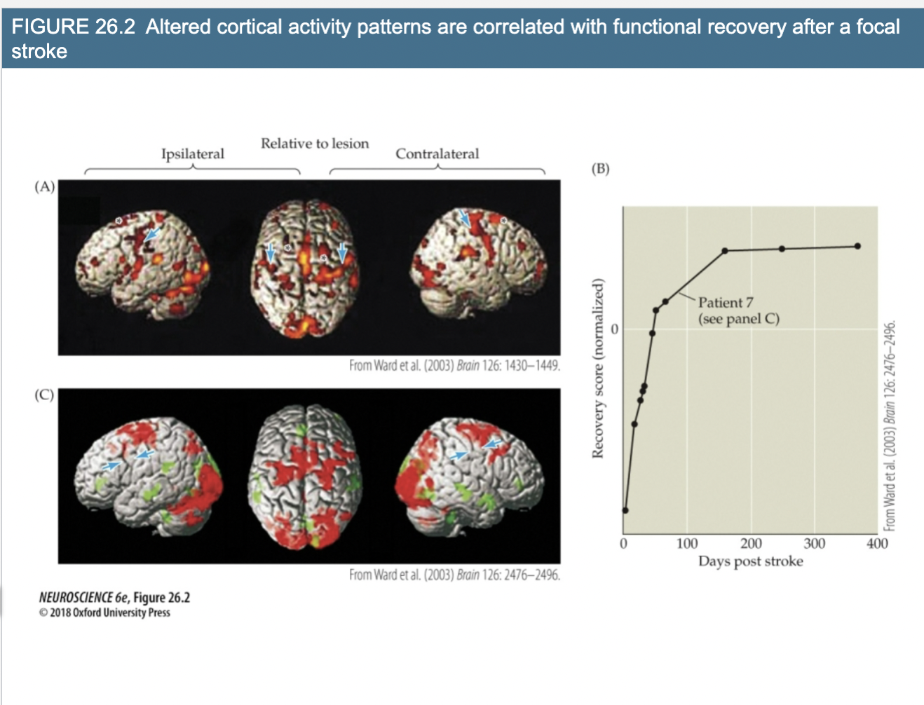 <p>Explain Figure 26.2- Altered cortical activity patterns are correlated with functional recovery after a focal stroke</p>