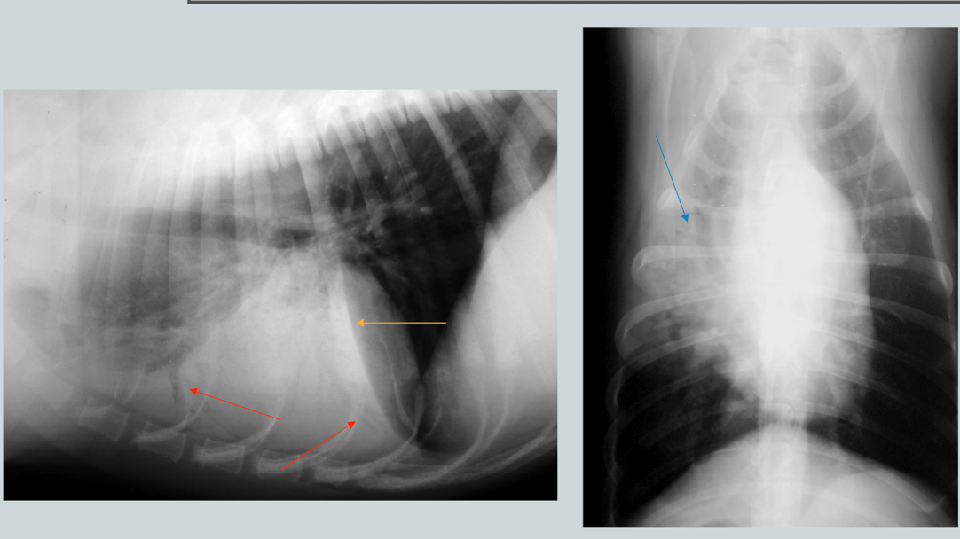 <p>What is the likely condition? What are the arrows pointing to? </p>