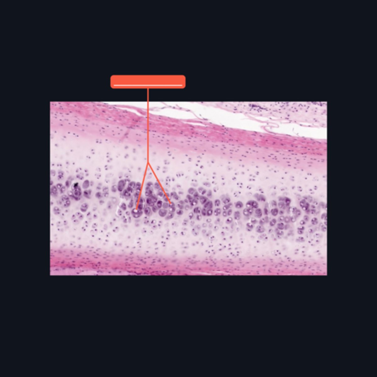 <p>In what structure can we locate a chondrocyte?</p>