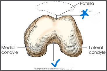 <p>what is labeled as the star?</p>