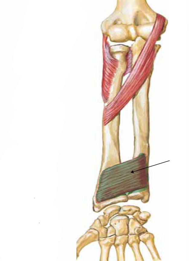 <p>What muscle is indicated</p>