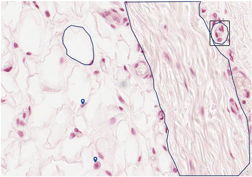 <p>identify area of histological slide, type of CT, and identify structures</p>