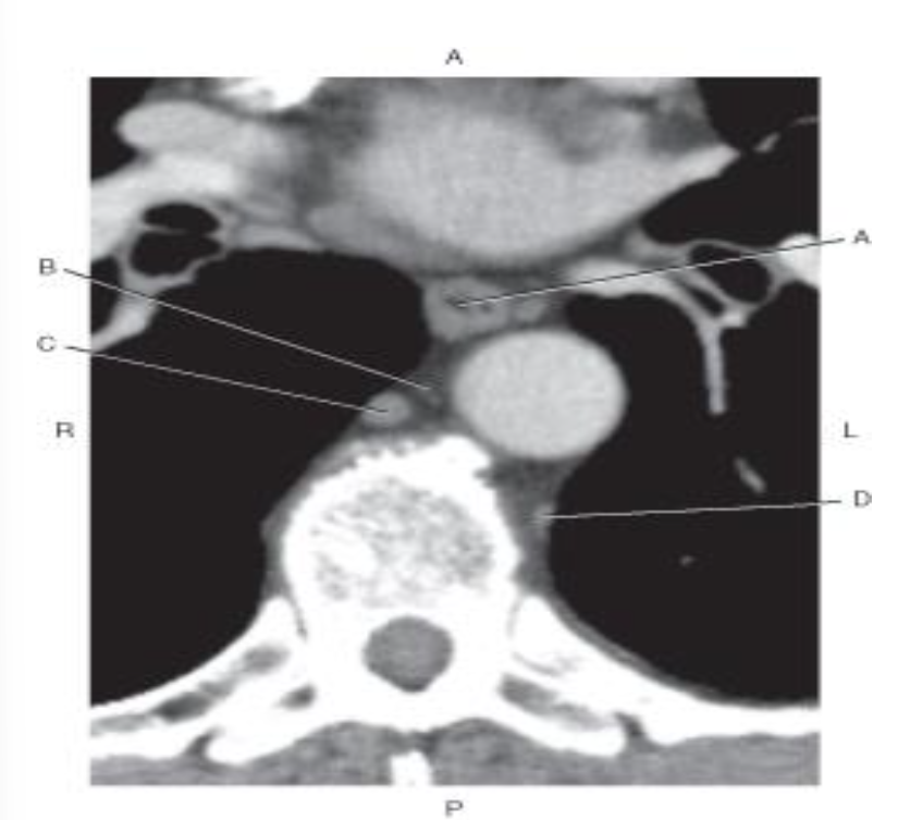 <p>Which line points to the <mark data-color="red">thoracic duct?</mark></p>