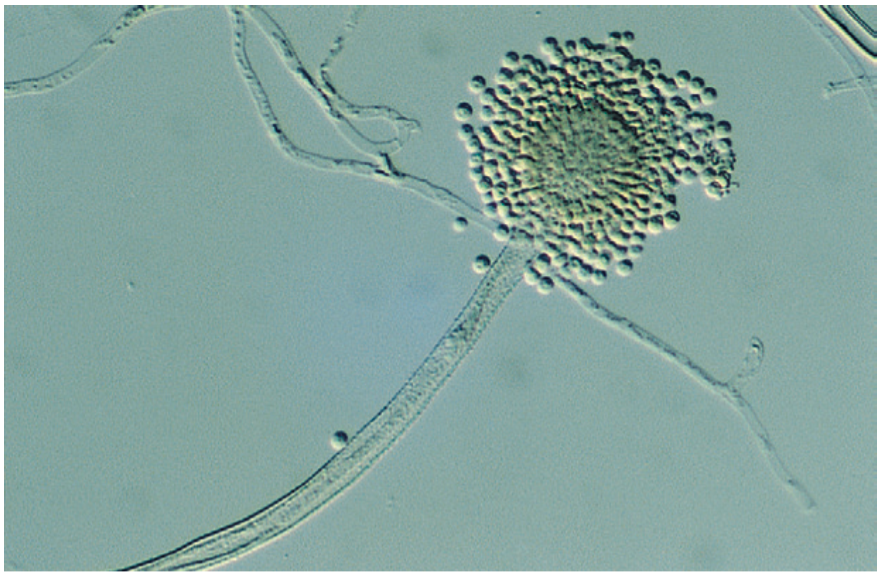 <p>Filamentous fungi with characteristic conidial heads.</p>