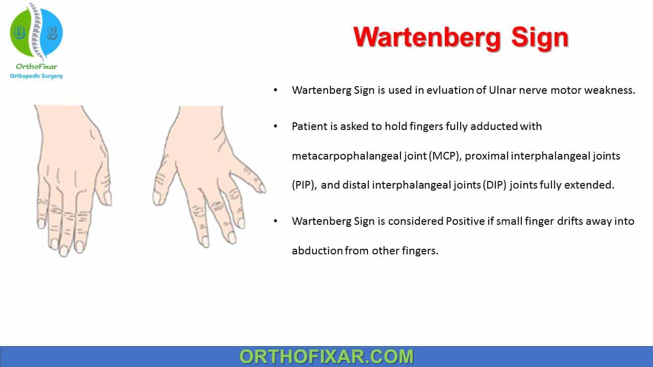 <p>-motor loss includes distal ulnar lesion, and flex carp ulnaris, flex digi prof IV and V (ring, little finger)<br>-functional loss of power grip<br>-positive Wartenberg’s Sign associated with ulnar nerve injury<br>OT int: MCP flexion block</p>