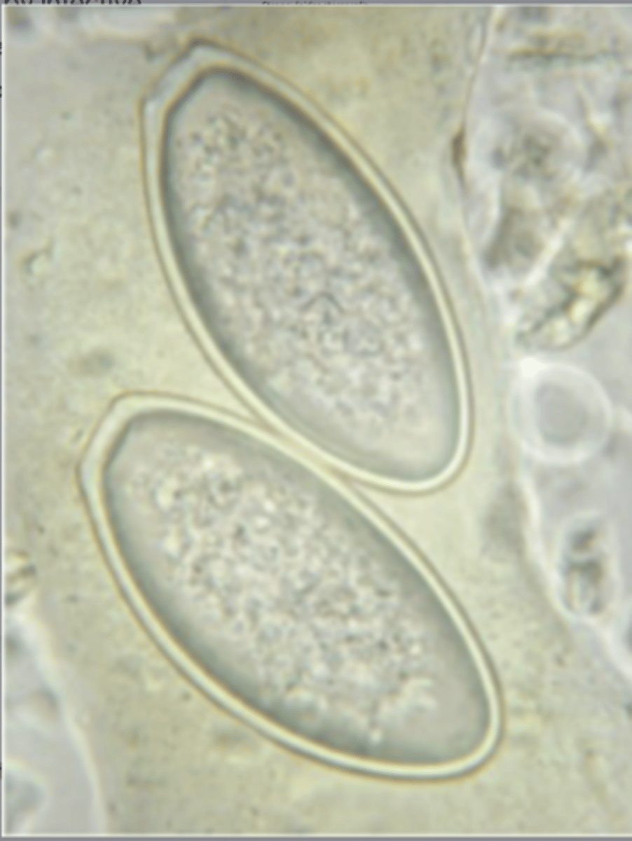 <p>These eggs were found in a scotch tape fecal from the perianal folds of a mare. The eggs are depicted in the picture. What is your diagnosis?</p>