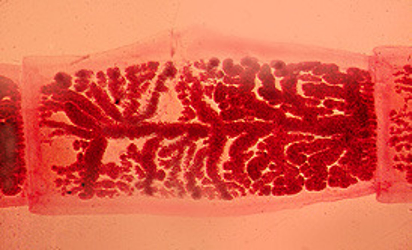 <p>Longer than broad</p><p>7-12 uterine branches</p><p>Lateral genital pore</p>