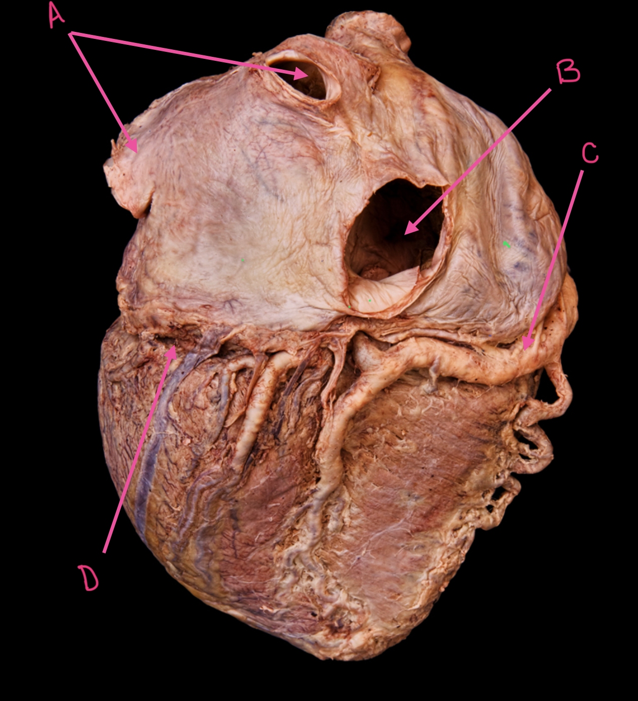 term image