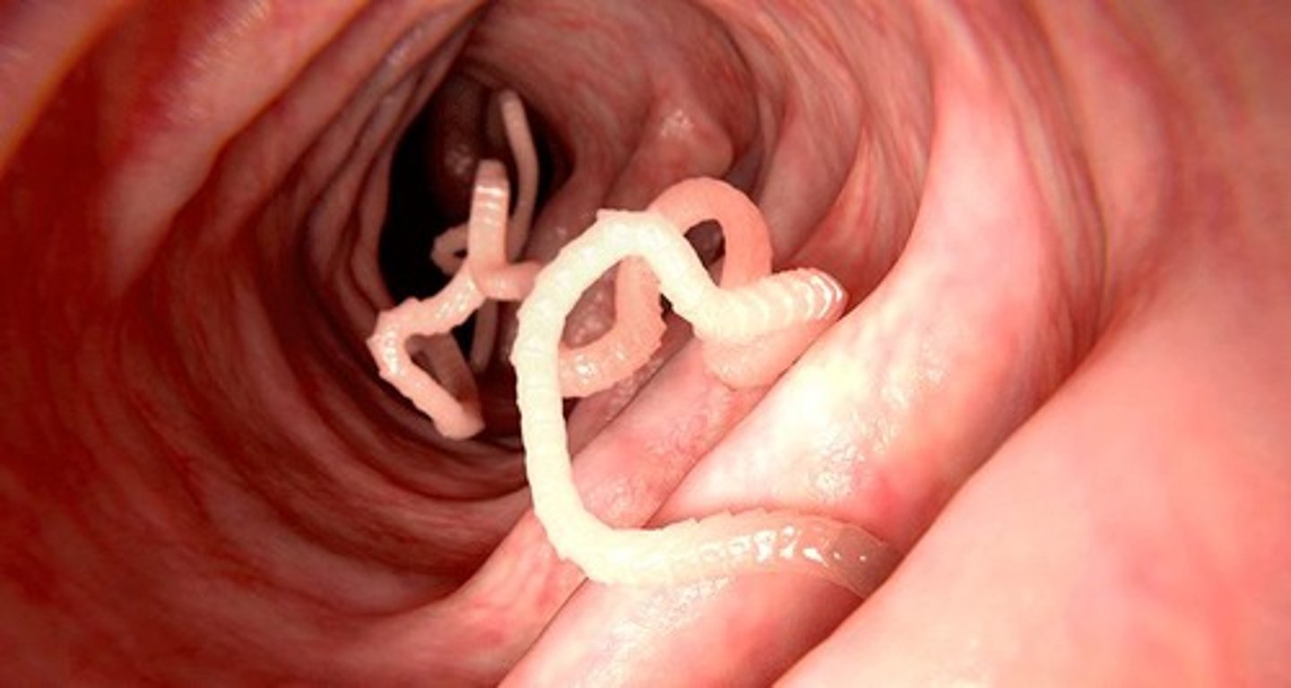 <p>An organism that lives in a host organism and gets its food from or at the expense of its host.</p>