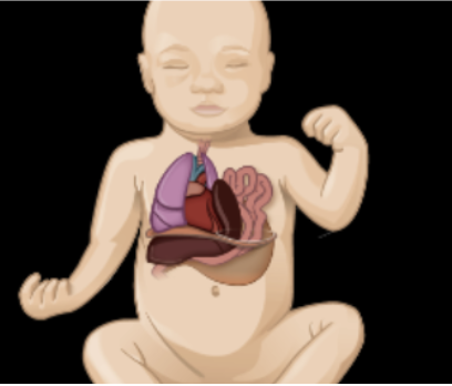 <p>What GI disorder is this?</p>
