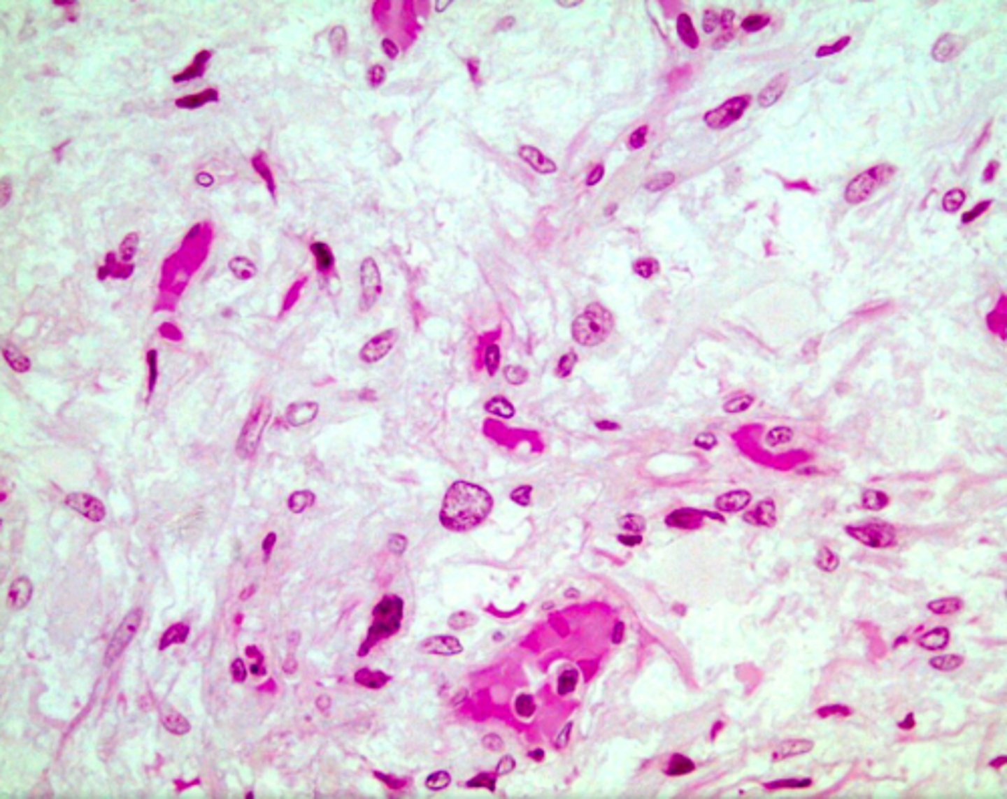 <p>lines in between pituicytes</p>