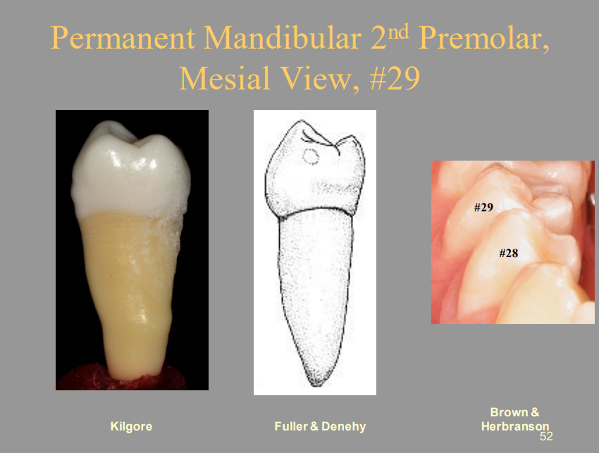 <p>Permanent Mandibular 2nd Premolar, Mesial View, #29</p>