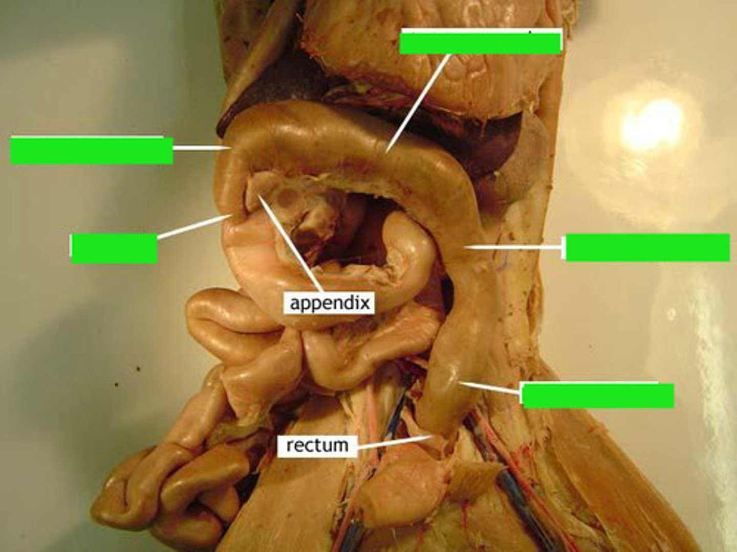 <p>Identify the structure at the green pointer boxes.</p>