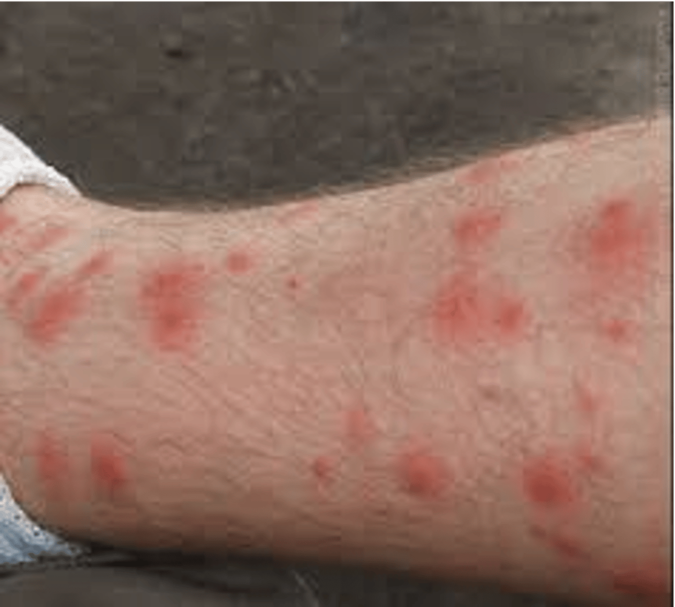 <p>feed on blood</p>