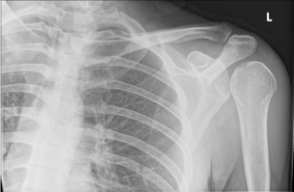 <p><span style="color: blue;"><strong>light bulb sign</strong></span></p>