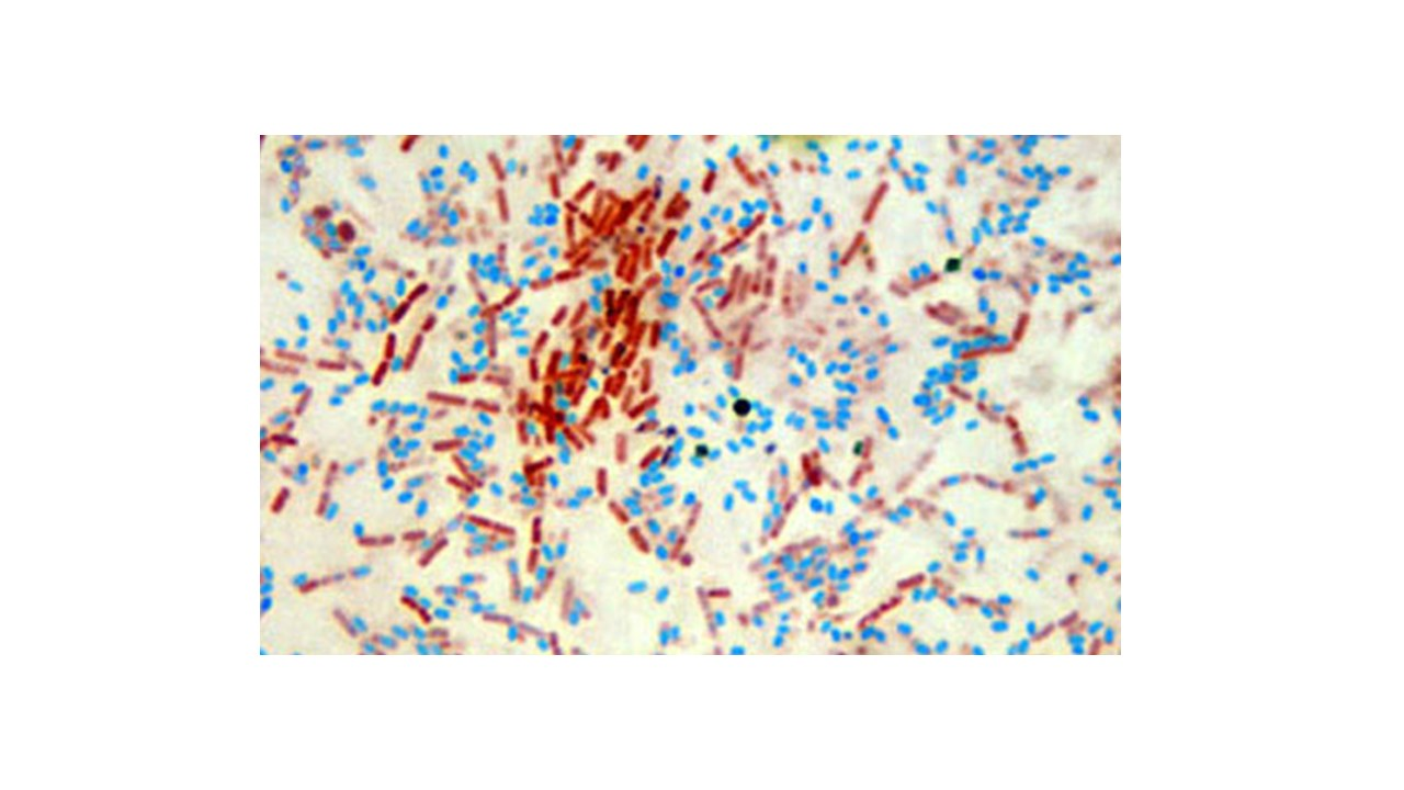 <p>l<span>ooking at the micrograph, does the bacteria Bacillus cereus produce spores</span></p>