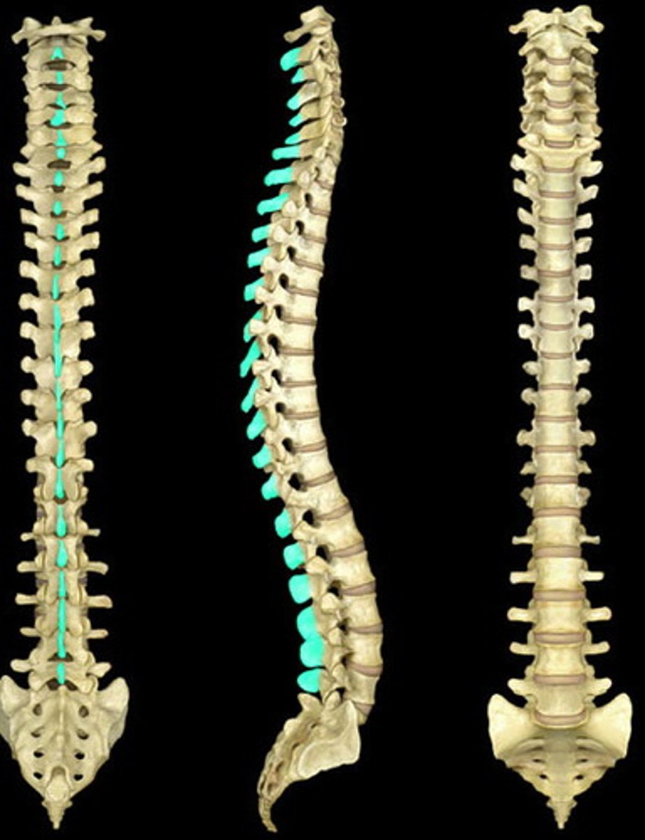 <p>The portion of the vertebrae that sticks out posteriorly.</p>