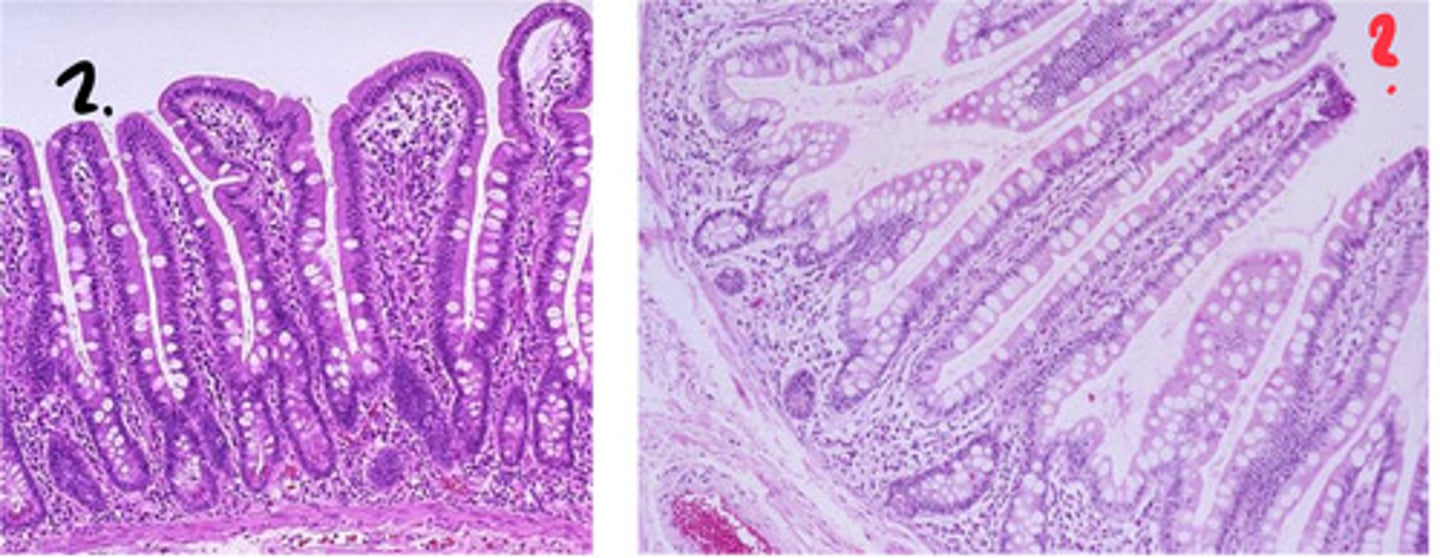 <p>left = duodenum</p><p>right = ilium</p><p>- goblet cell number increases from proximal to distal</p>