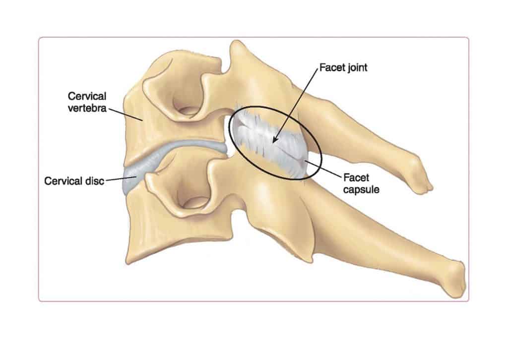 <p>facet (zygapophysial) joint</p>