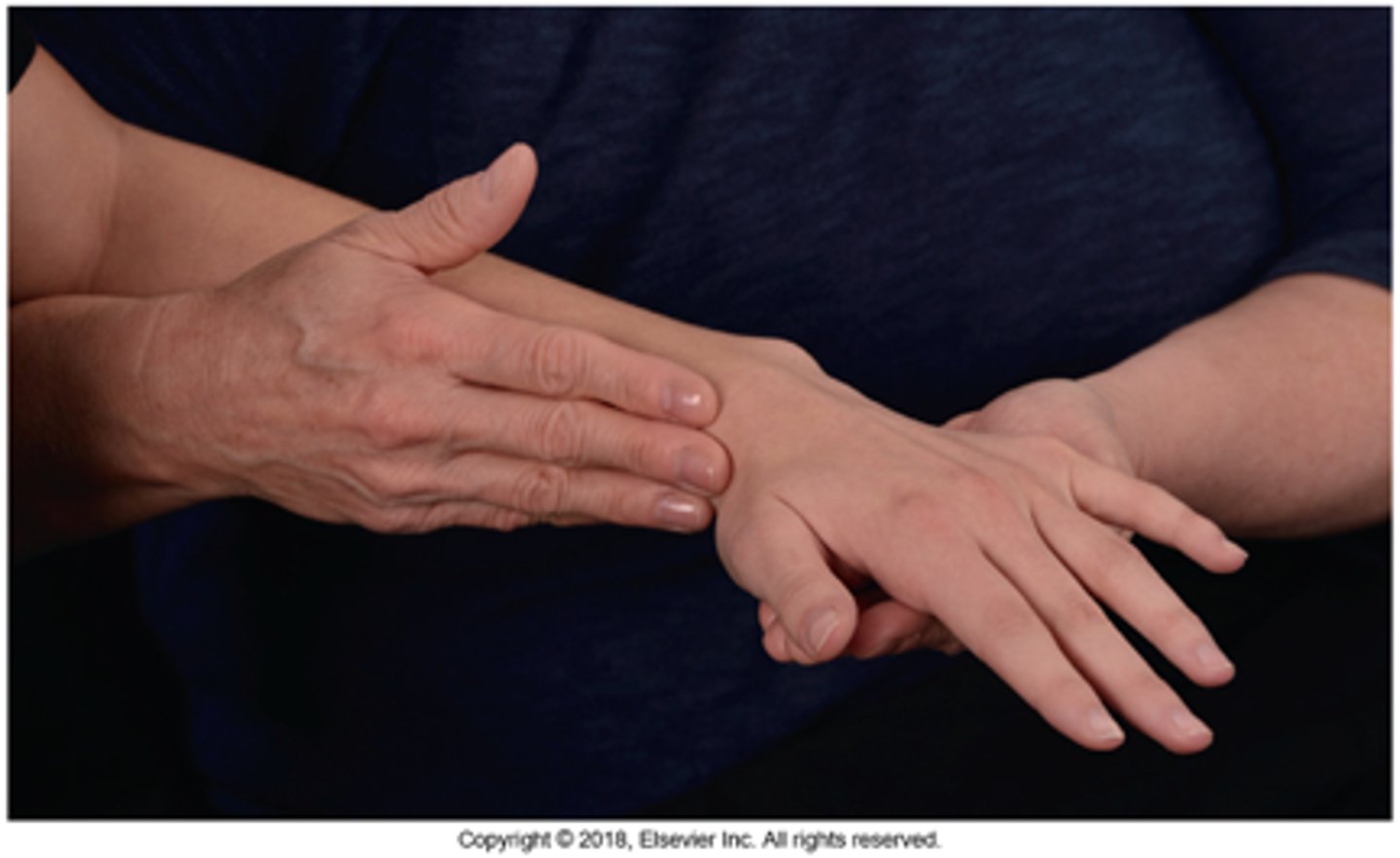 <p>Patient Position: Sitting with forearm pronated and hand resting on tabletop</p><p>Palpation: ECRL &amp; ECRB at dorsal wrist + FCR at volar wrist</p><p>Compensations: Elbow flexion &amp; finger/thumb abduction</p>