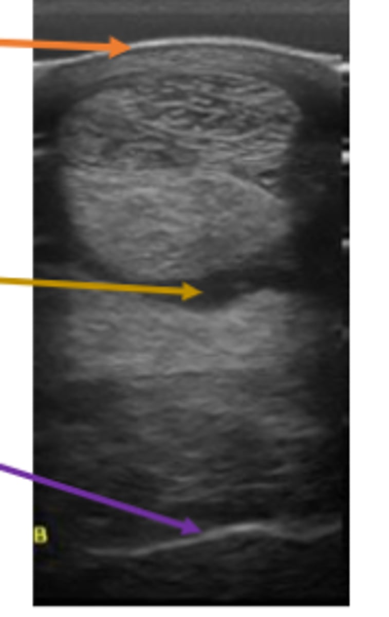 <p>Waves traveling through the tissue depends on the tissue’s _____ ______</p>