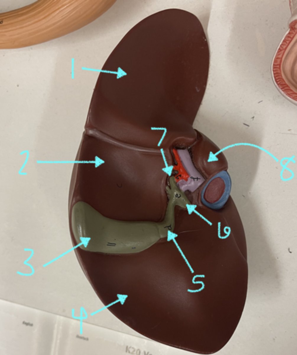 <p>what is structure 2</p>