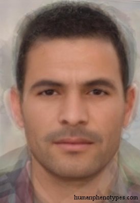 <p>Identify this Phenotype</p>