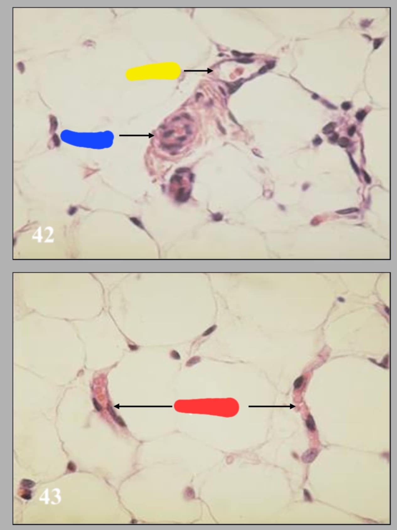 <p>name the 2 diff slides and their parts</p>