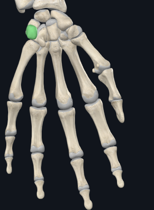 <p>What bone is this</p>