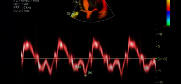 <p>what is this measurement for</p>