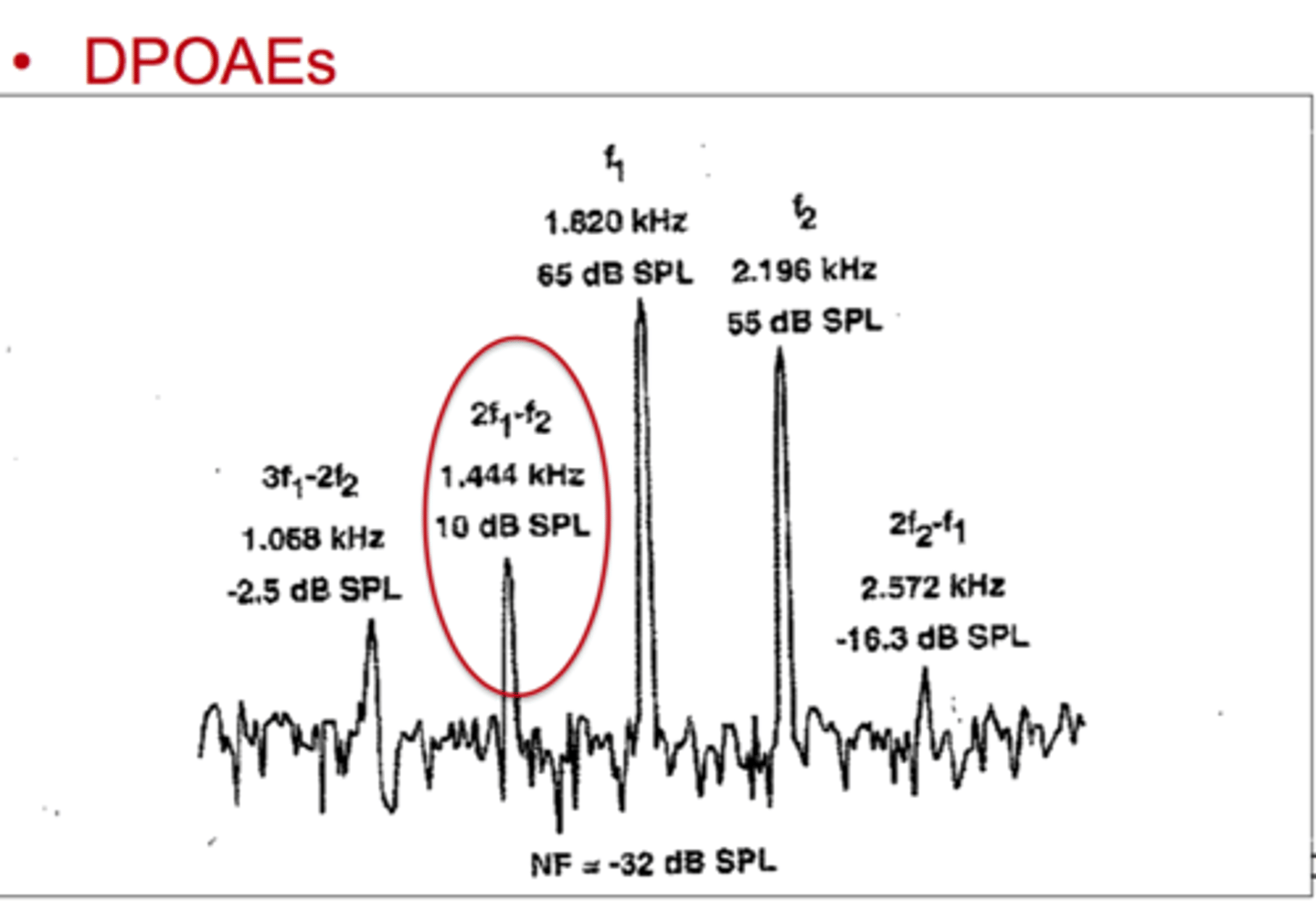 <p>Pairs of tones tones enter the outer, middle, and inner ear, recording microphones pick up the small sounds coming back from the inner ear, computer averages and processes the responses</p><p>Amplitude is greatly reduced or absent with OHC loss</p>