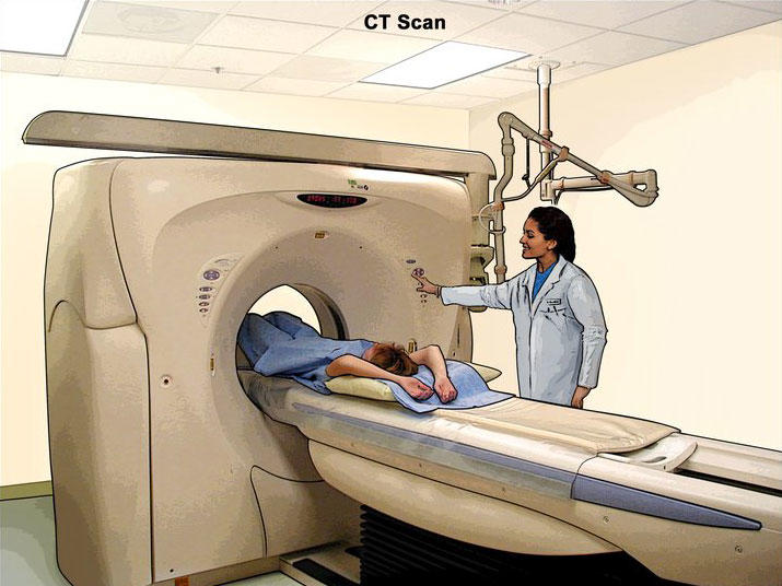 Computed Tomography (CT)