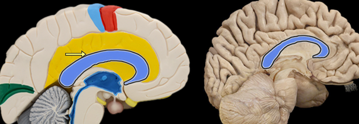<p>Location:</p><ul><li><p>Brain, between cerebral hemispheres</p></li></ul><p>Description:</p><ul><li><p>Large myelinated fiber tract connecting right and left cerebral hemispheres</p></li><li><p>Forms floor of longitudinal fissure</p></li></ul><p></p>