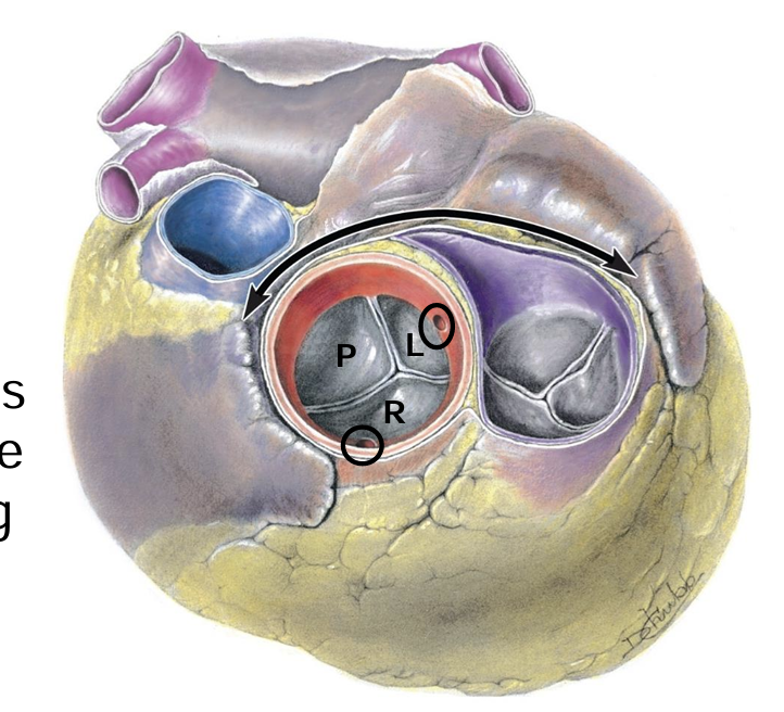 <p> aortic sinuses at the proximal part of the ascending aorta</p><p></p><p>sinus: space between the cusp and the wall of the aorta</p><p>-in systole the cusp lies on the side of the ascending aorta, pushing blood first into the two opening of tehe left and right coronary arteries</p><p>-in diastole there is a space forming a sinus, and blood will pool in the cusps</p><p>-there are 3 sinuses: left, right and pulmonary</p>