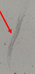 <p>cattle lungworm</p>