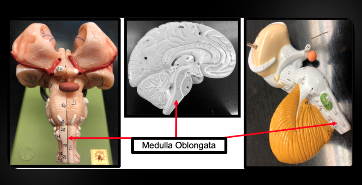 <p>Medulla Oblongata</p>