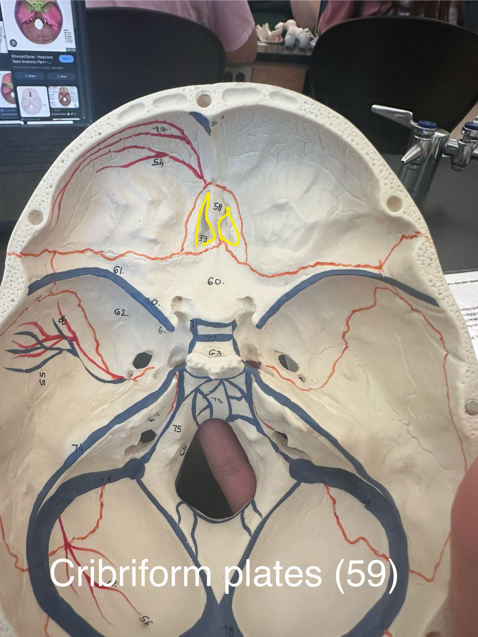 <p>Cribriform Plates</p>
