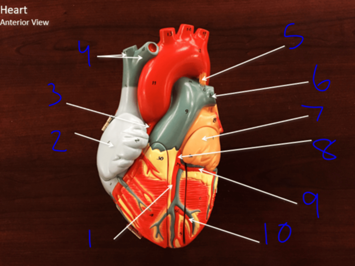 <p>Anterior View 2 - #2</p>