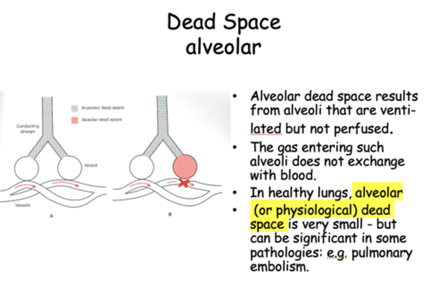 <p>alveolar dead space</p>