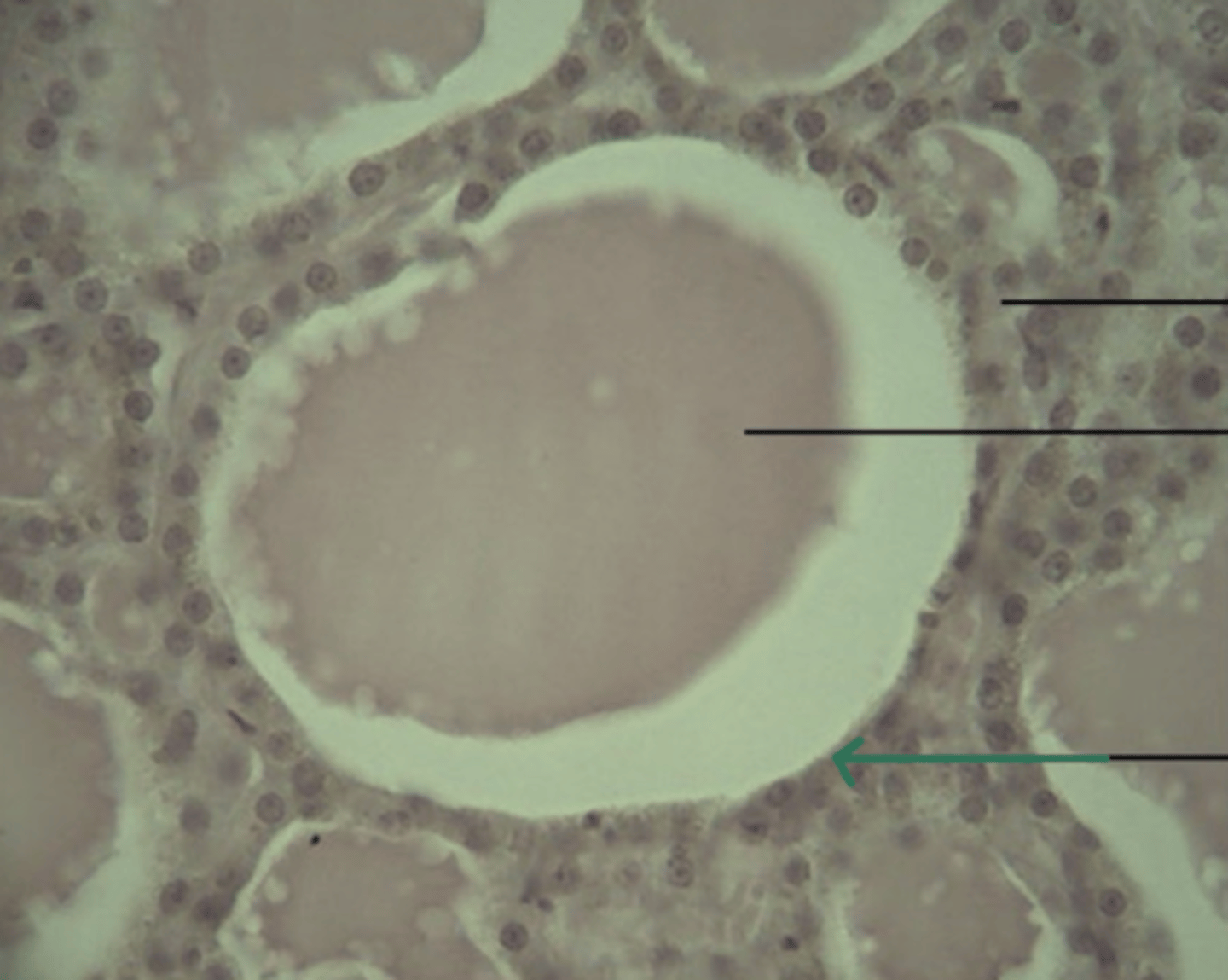 <p>gland and structure</p>