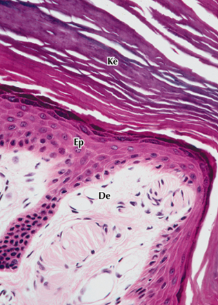 <p>epiteliu stratificat pavimentos keratinizat</p>