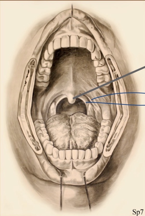 <p>Quels éléments sont visibles dans l’ouverture buccale sur la vue supérieure anatomique (dia 1) ?</p>
