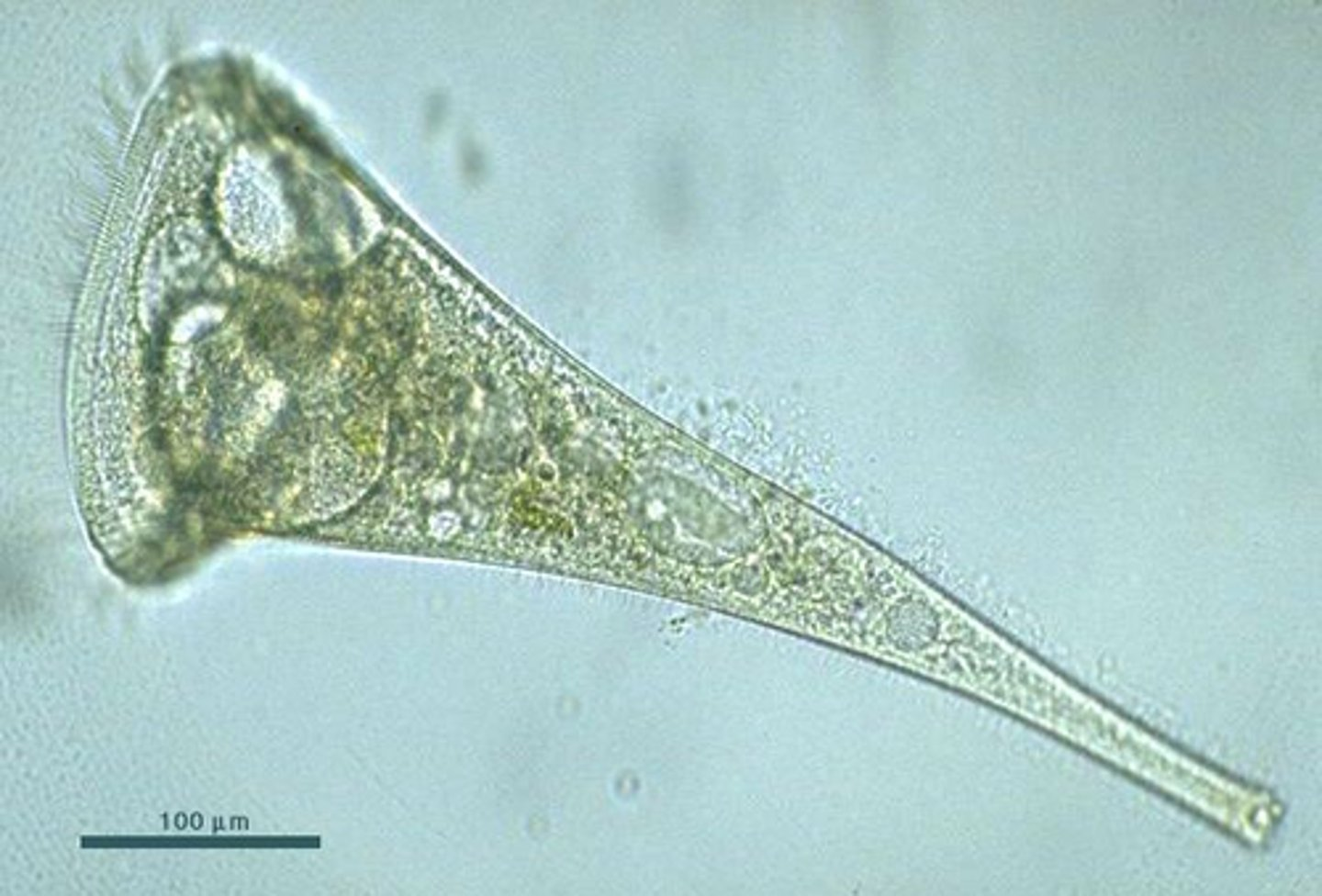 <p>Which of the following is NOT a feature you would expect to find in the above organism?</p>