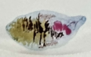 <p><span data-name="microscope" data-type="emoji">🔬</span><span data-name="petri_dish" data-type="emoji">🧫</span><strong><span> </span>Na podstawie zdjęcia preparatu:</strong></p><p></p><ul><li><p><span data-name="book" data-type="emoji">📖</span><span> </span>rozpoznaj gatunek pasożyta;</p></li></ul><p></p><ul><li><p><span data-name="recycle" data-type="emoji">♻</span><span> </span>rozpoznaj wszystkie formy rozwojowe;</p></li></ul><p></p><ul><li><p><span data-name="microbe" data-type="emoji">🦠</span><span> </span>wskaż organelle i cechy charakterystyczne dla danego gatunku;</p></li></ul><p></p><ul><li><p><span data-name="mask" data-type="emoji">😷</span><span> </span>nazwij chorobę, którą pasożyt wywołuje.</p></li></ul><p></p>