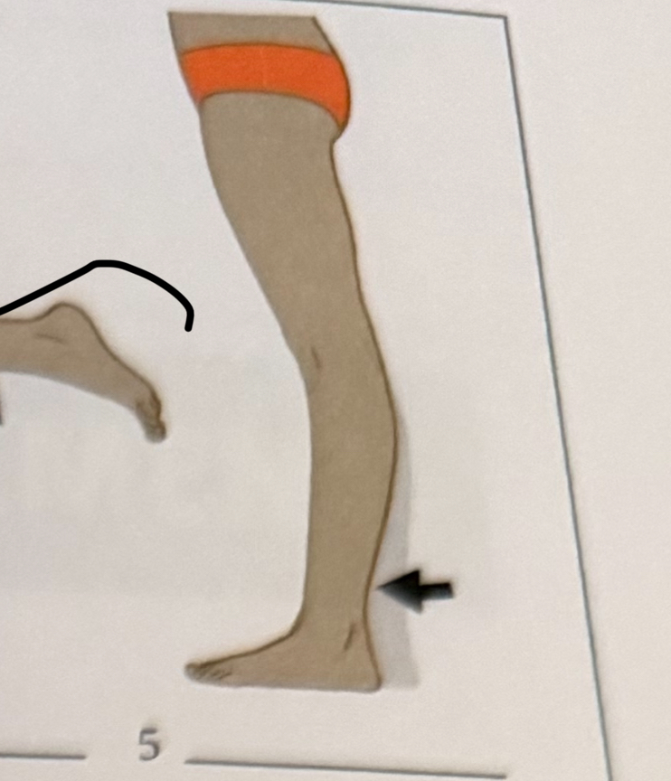 <p>moving a part so that the end follows a circular path</p>